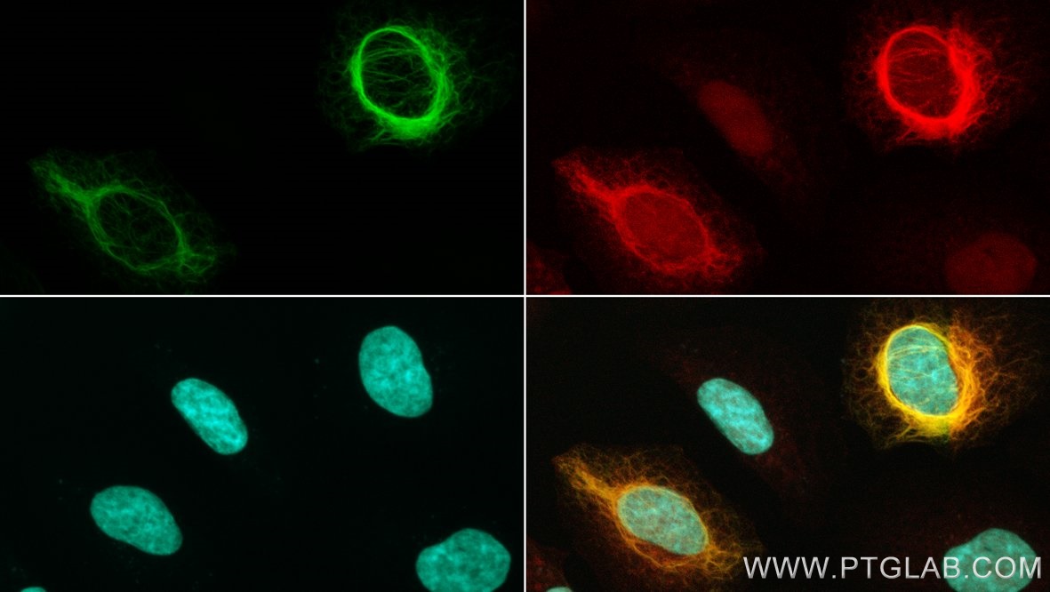 Fluorescence microscopy of HeLa cells, transiently expressing Vimentin-mNeonGreen (green) and the mNeonGreen-Chromobody-(mCherry) (red). Nuclei are stained with DAPI (cyan). 
Green and red fluorescent signals co-localize in co-transfected cells, indicating enrichment of the Chromobody at the mNeonGreen-positive structures. Confocal images were were acquired with a 63x oil objective and post-processed.