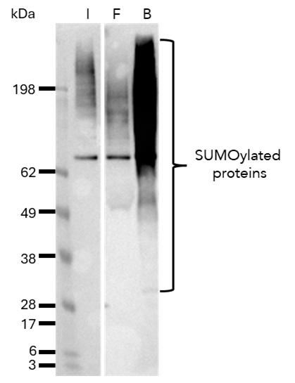 The SUMO1-Trap Magnetic Agarose (s1tma) was used to immunoprecipitate endogenous SUMO1ylated proteins from a human cell line. Samples of the input lysate (I), non-bound flow-through (F) and bound (B) fraction were analyzed using Western blot. 
SUMO1ylated proteins are highly enriched using the SUMO1-Trap. 
Data kindly provided by Prof. Alfred Vertegaal, Leiden University, The Netherlands.