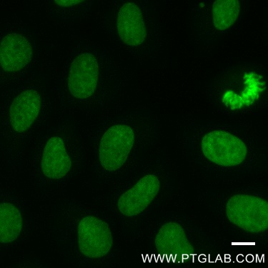 Hela cells immunostained with Histone-Lable-ATTO488, 1:400. Scale bar, 10 um.