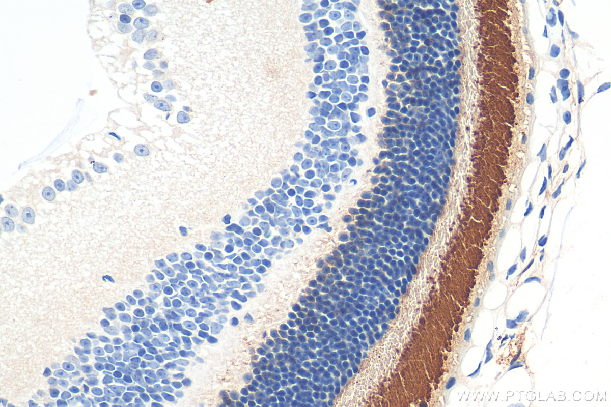 IHC staining of mouse eye using 30438-1-AP