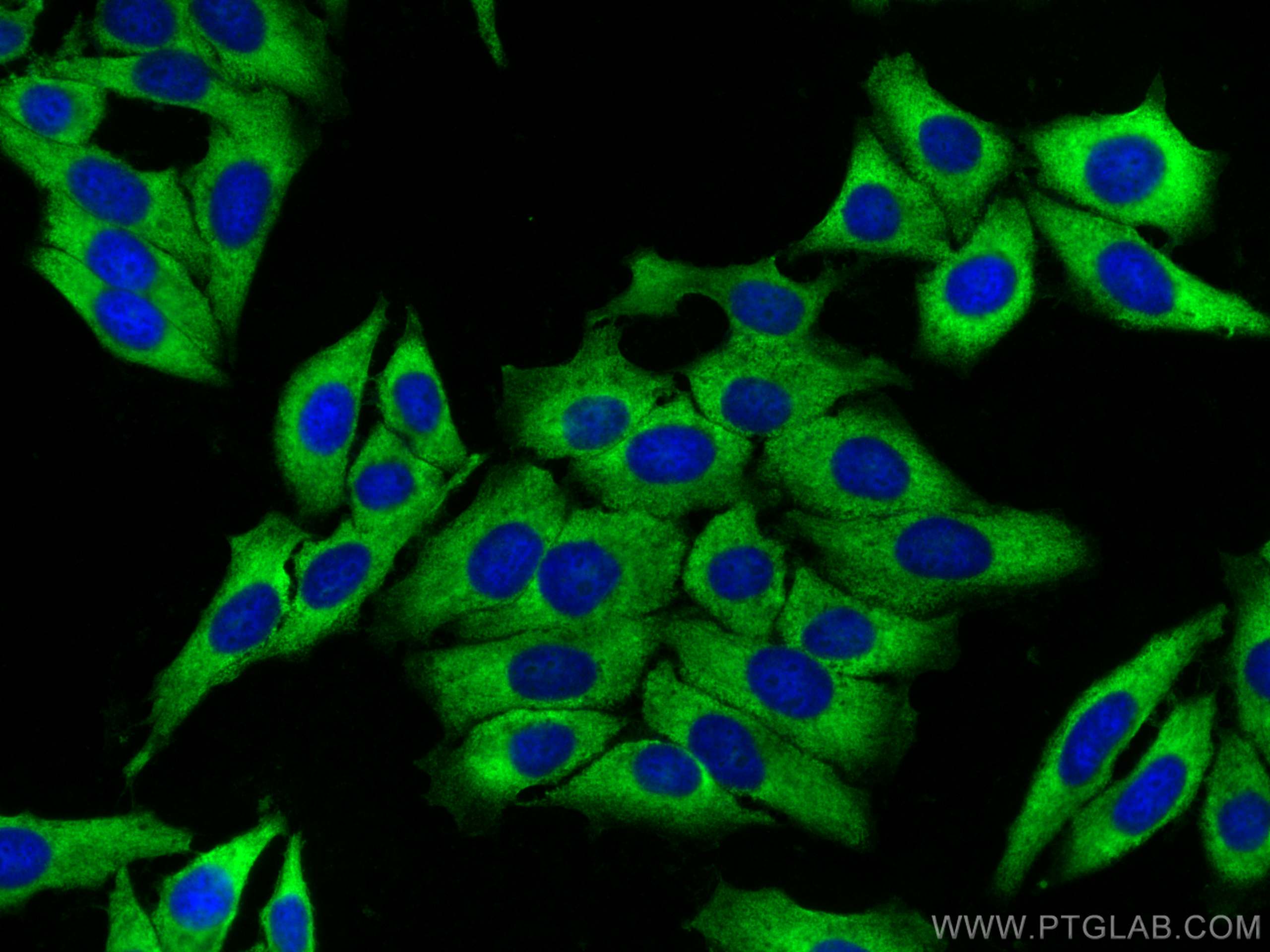 IF Staining of HepG2 using 30182-1-AP