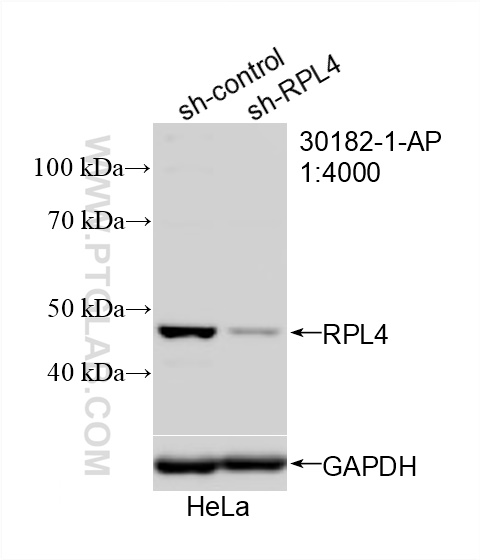 WB analysis of HeLa using 30182-1-AP