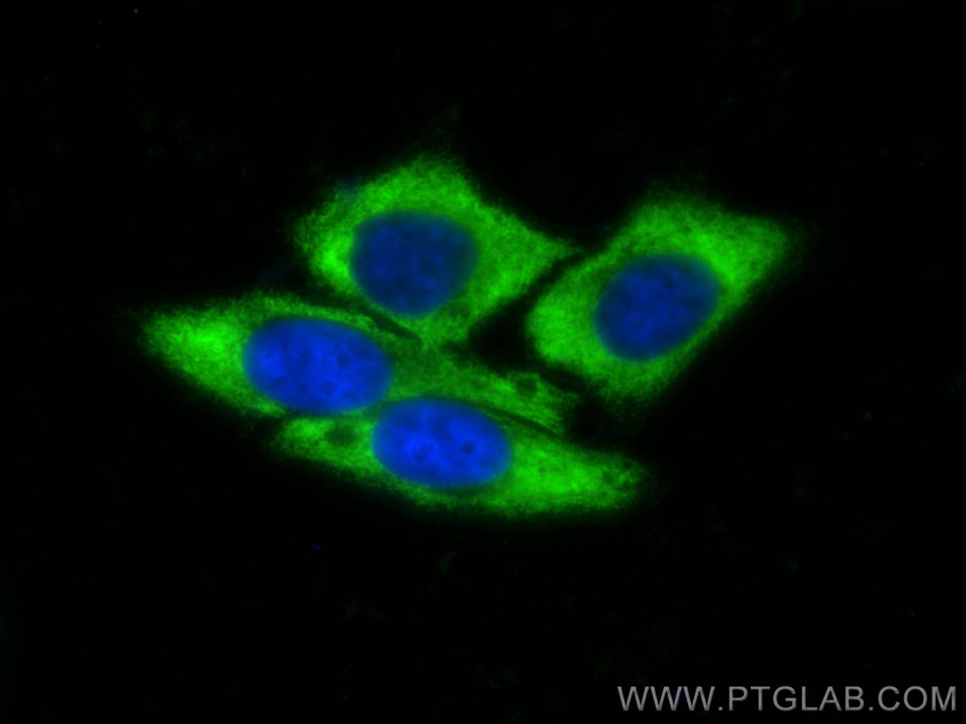 IF Staining of HepG2 using CL488-11302