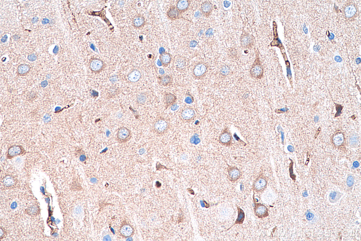 IHC staining of rat brain using 67237-1-Ig (same clone as 67237-1-PBS)