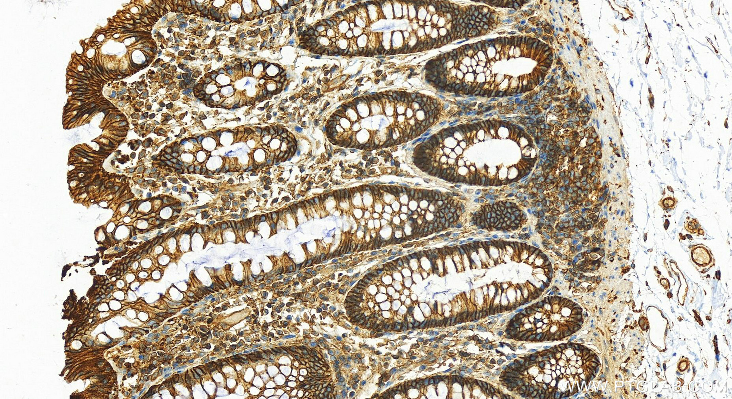 IHC staining of human colon using 11250-1-AP