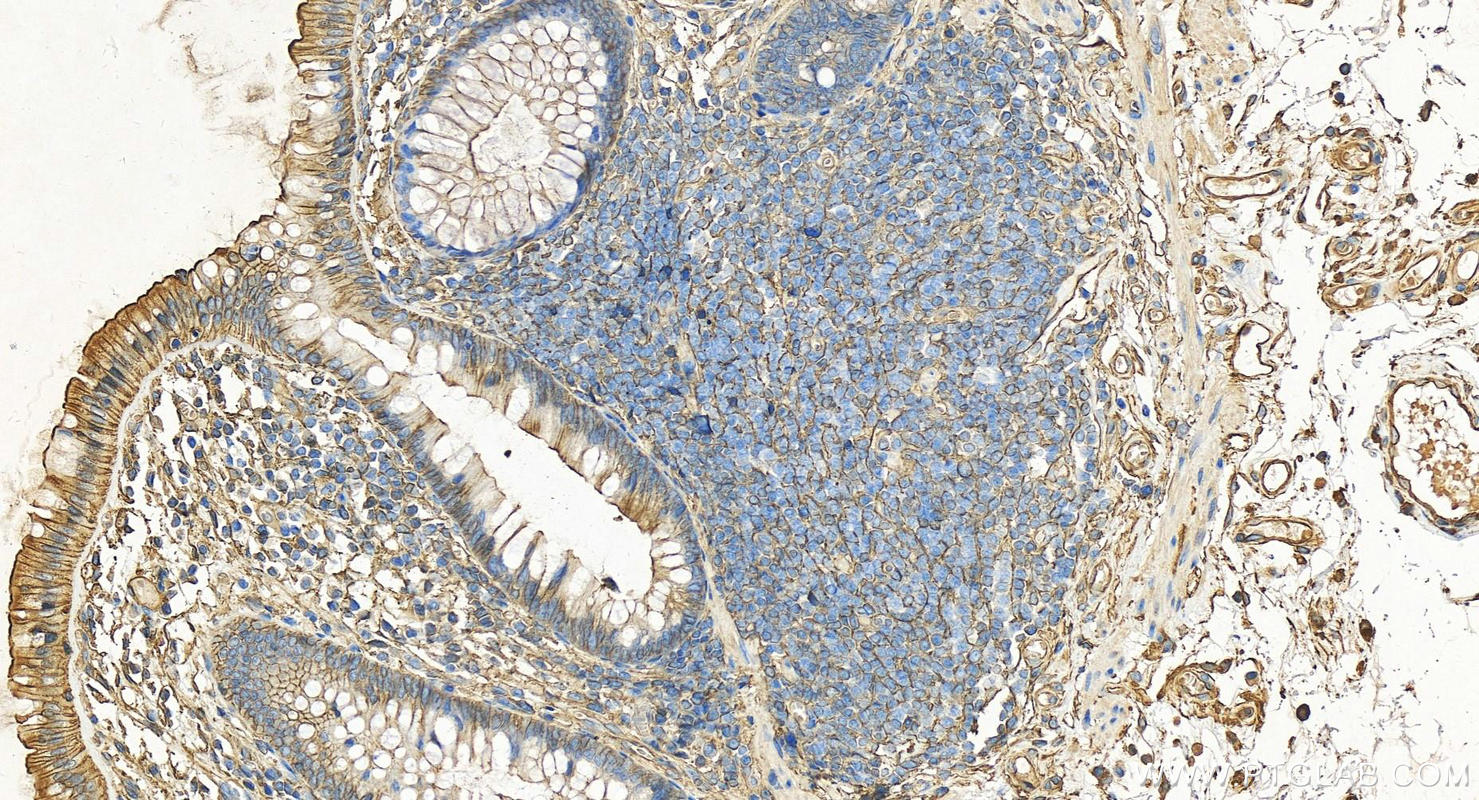 IHC staining of human colon using 11250-1-AP