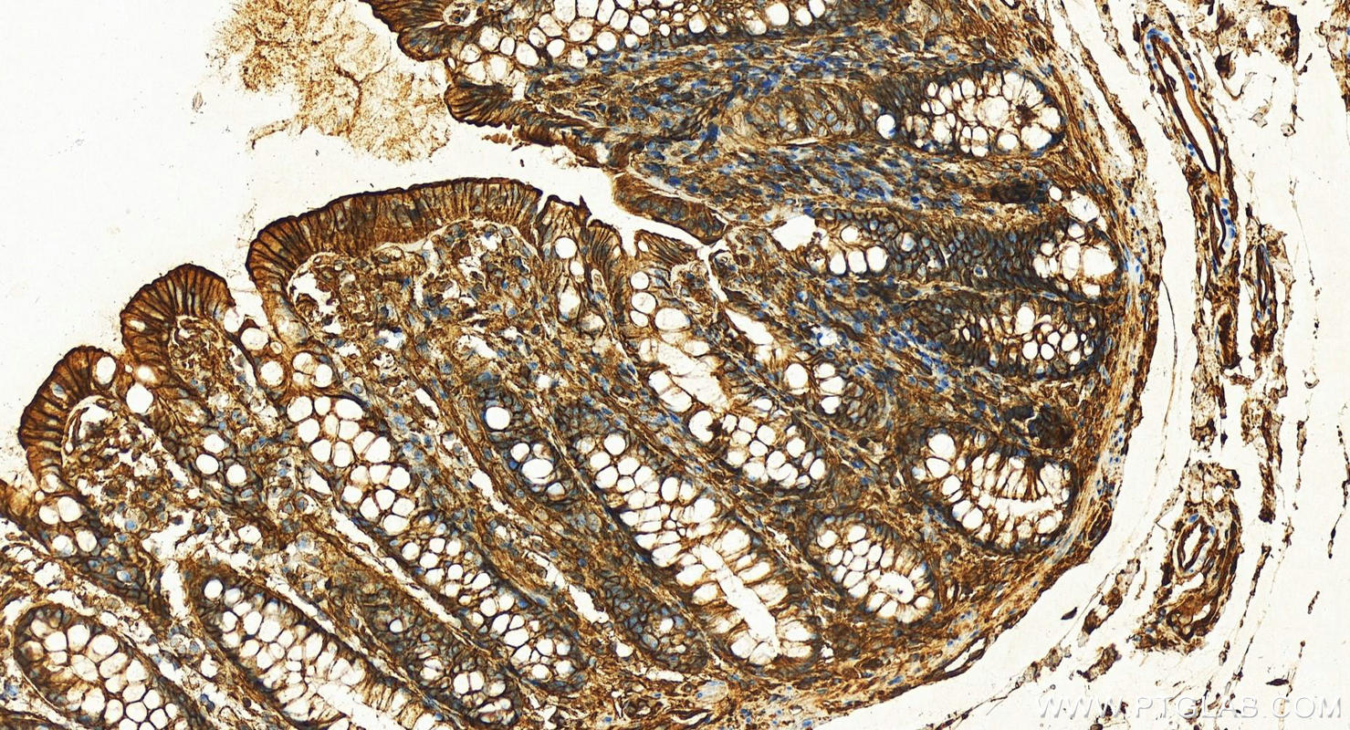 IHC staining of human colon using 81017-1-RR