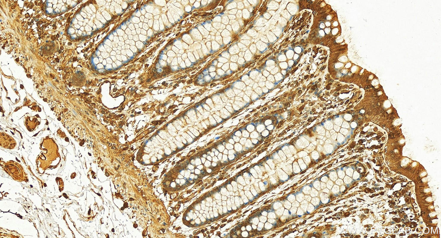 IHC staining of human colon using 10237-1-AP