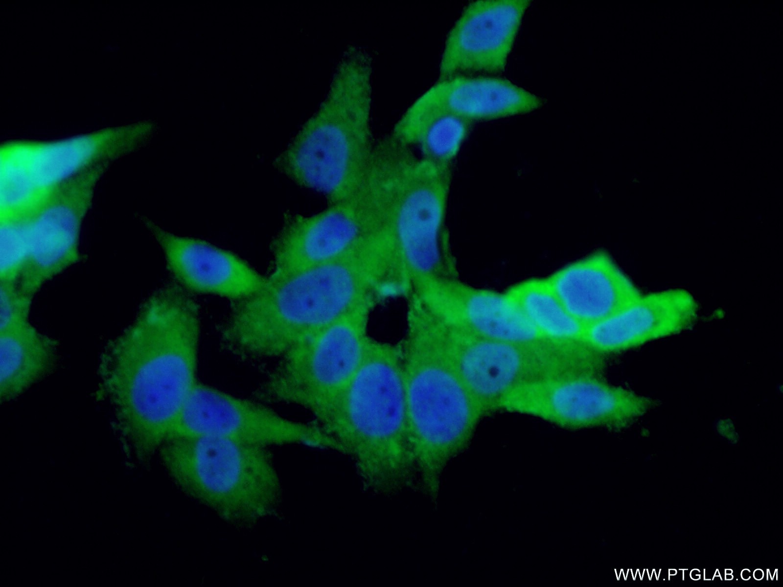 IF Staining of MCF-7 using 14987-1-AP