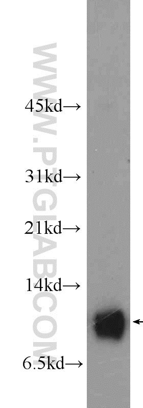 WB analysis of MCF-7 using 14987-1-AP