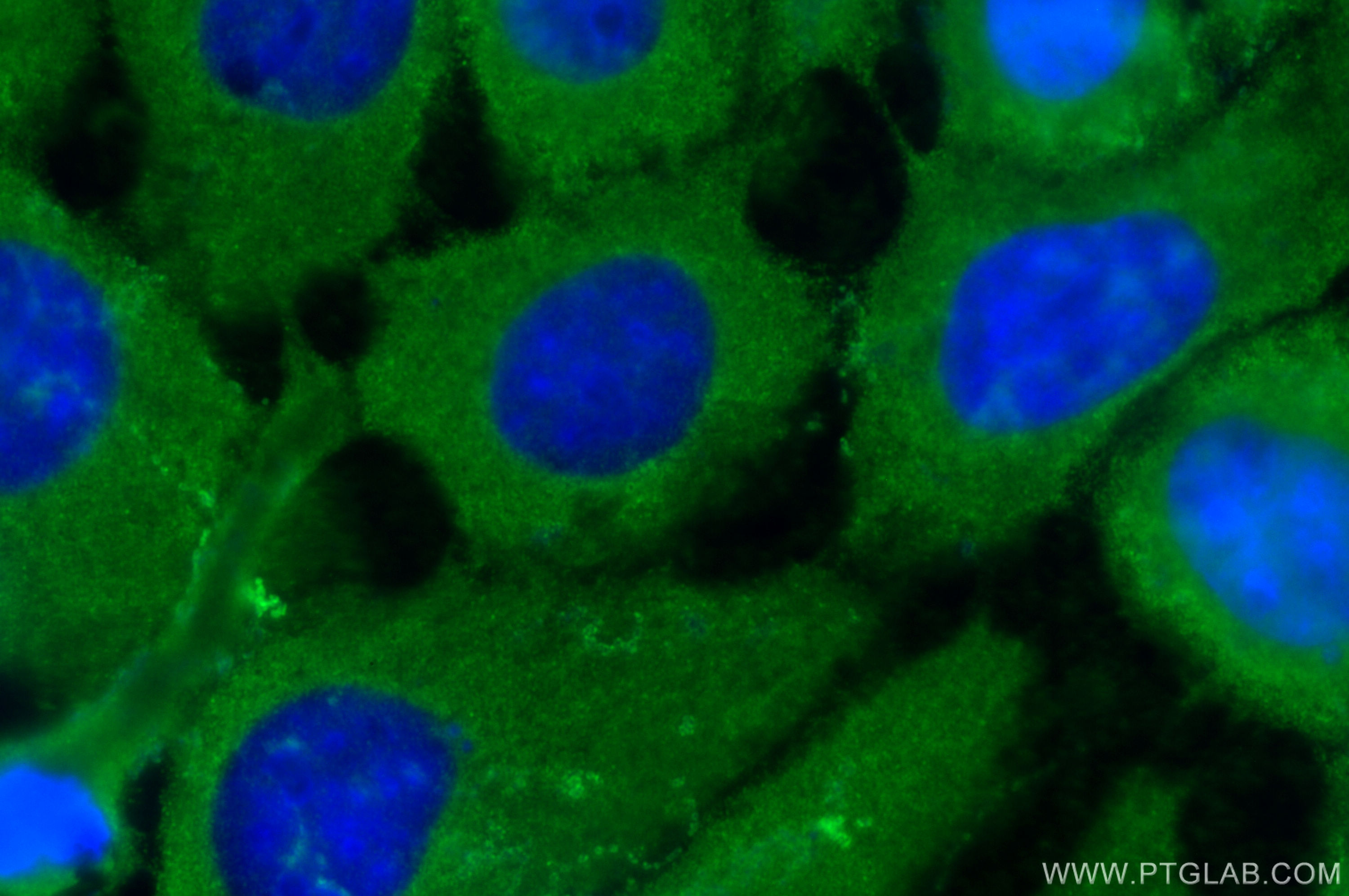 IF Staining of A431 using 15454-1-AP