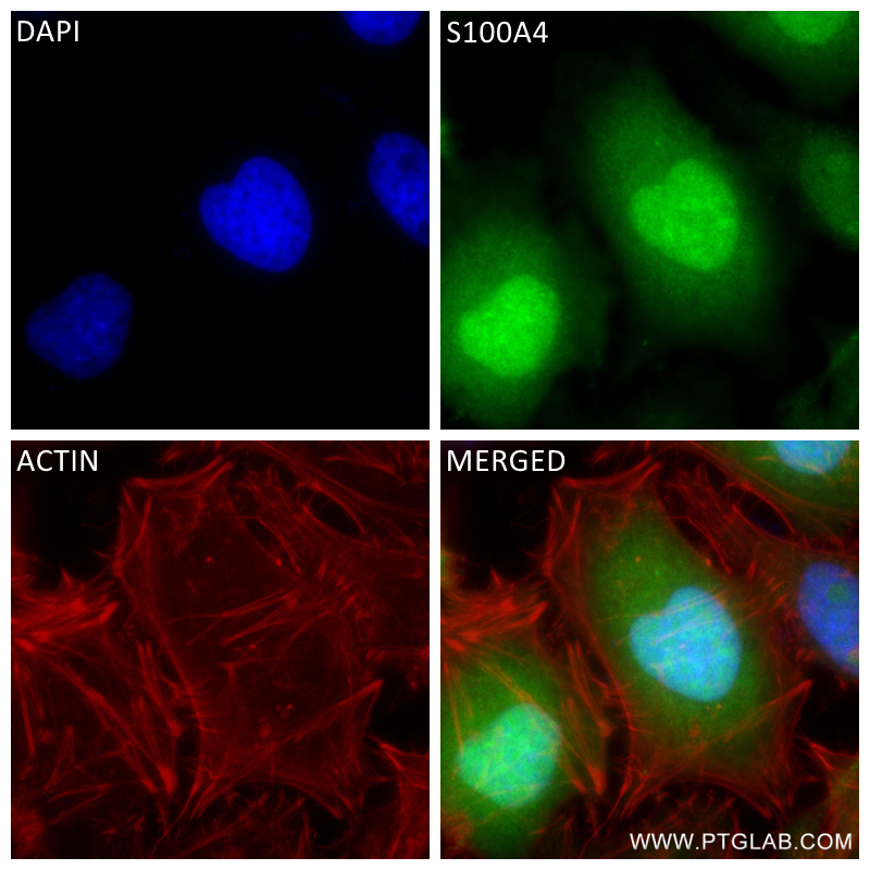 IF Staining of HeLa using 84221-1-RR