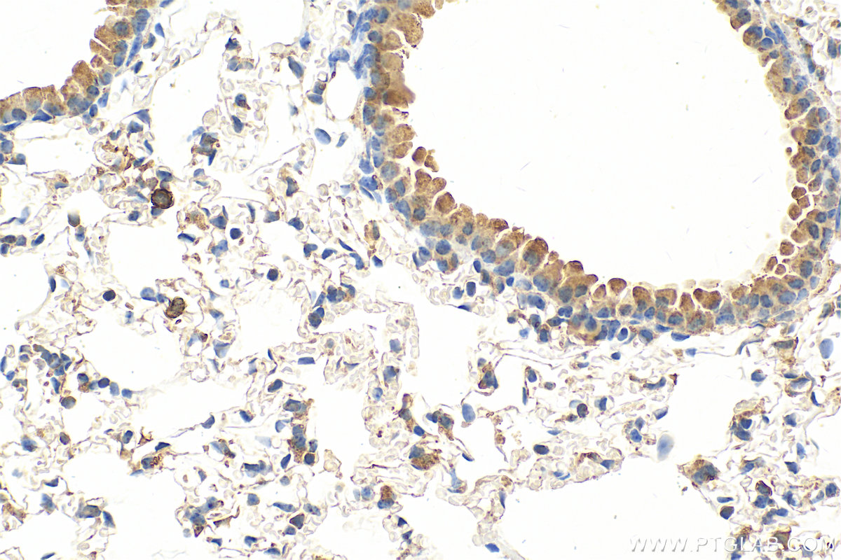 IHC staining of mouse lung using 15792-1-AP