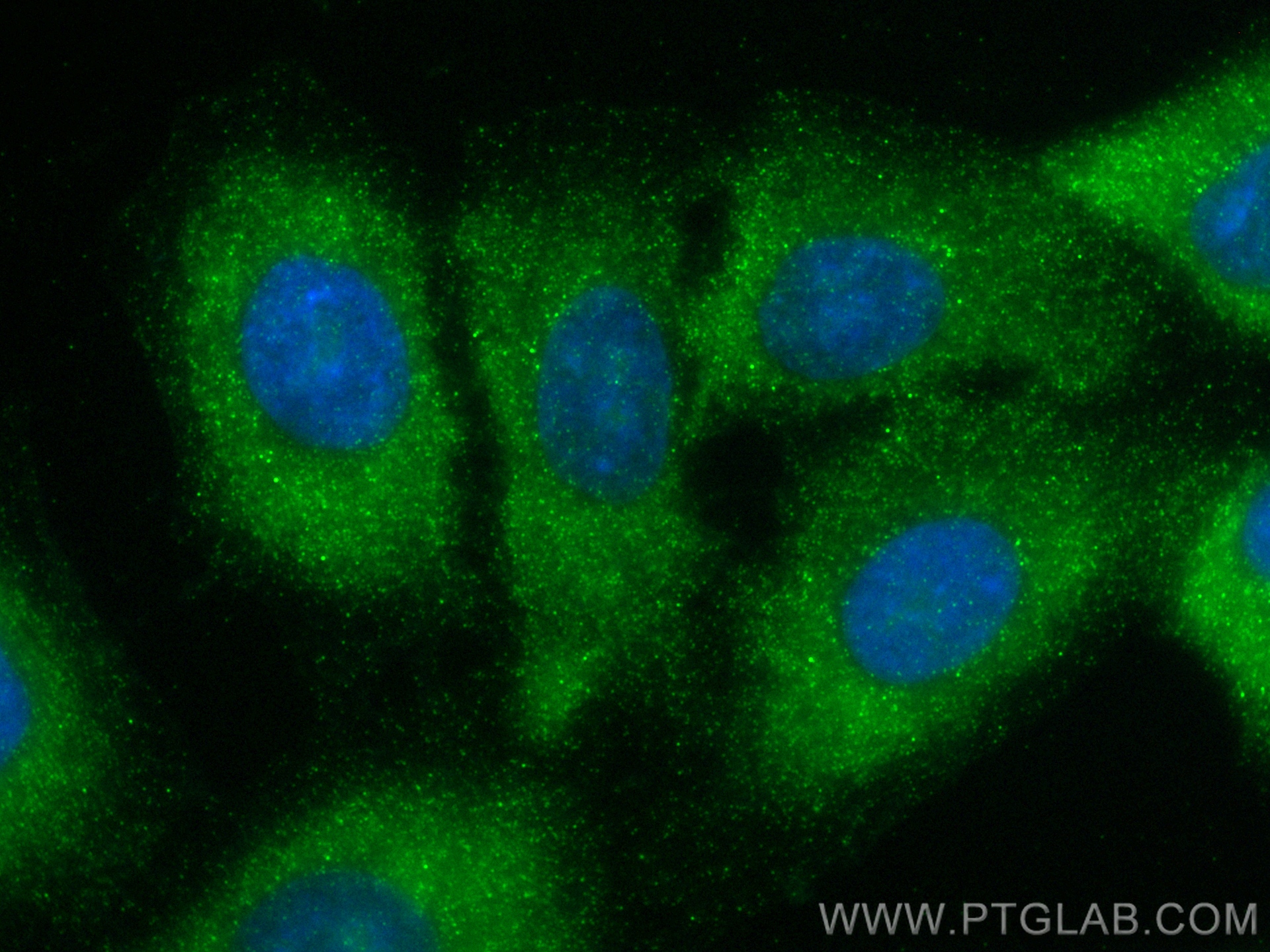 IF Staining of A549 using 83578-2-RR (same clone as 83578-2-PBS)