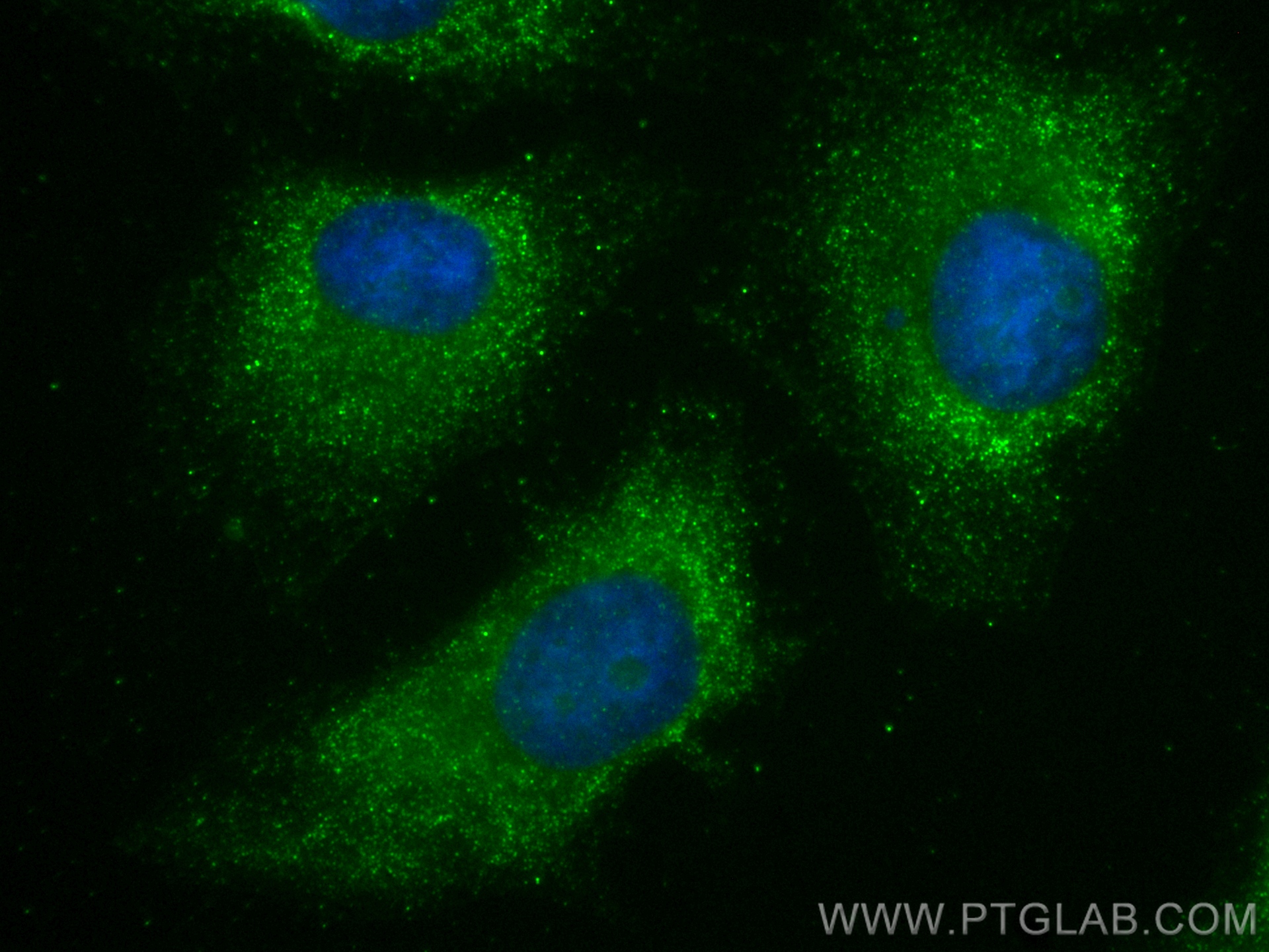 IF Staining of HeLa using 83578-2-RR (same clone as 83578-2-PBS)