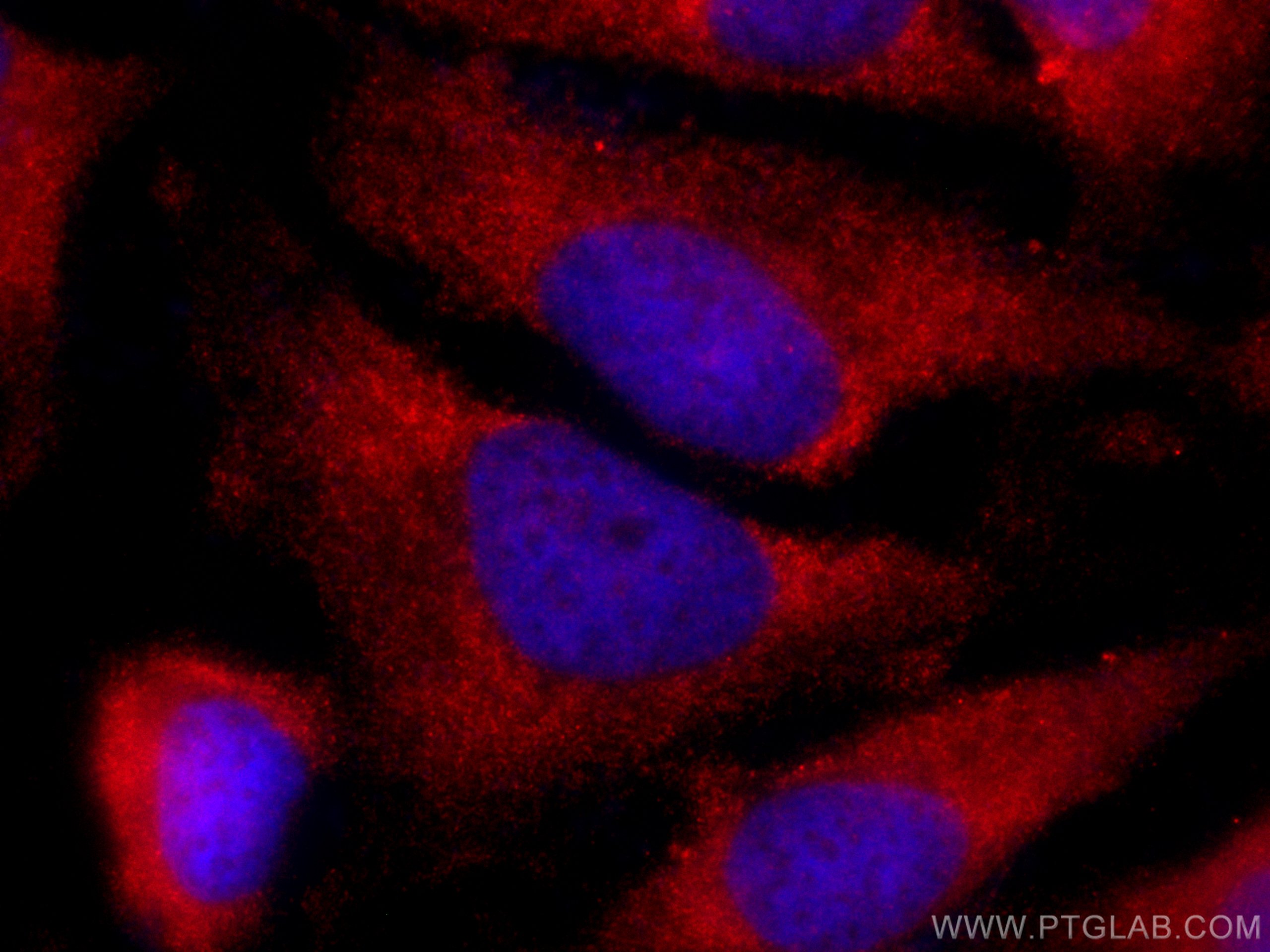 IF Staining of HeLa using CL594-26992