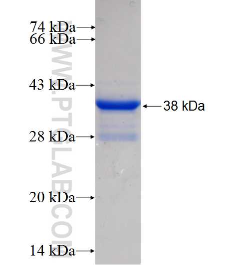 SAA1 fusion protein Ag10160 SDS-PAGE