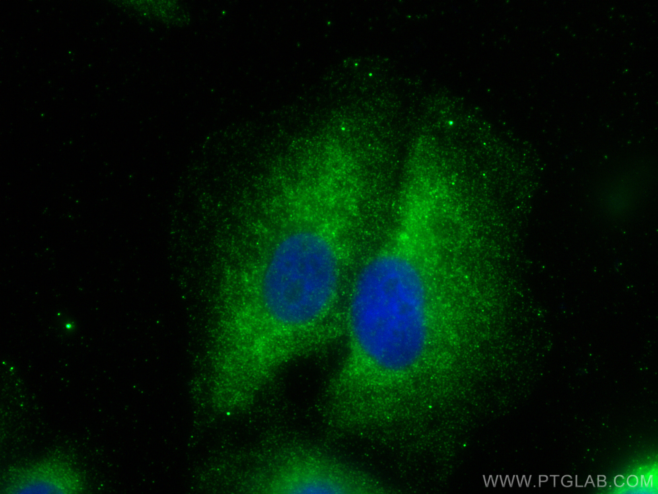 IF Staining of A549 using 13192-1-AP