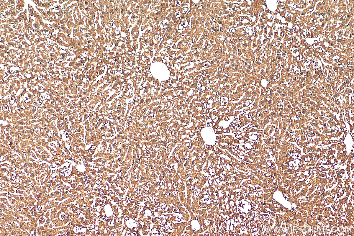 IHC staining of mouse liver using 13192-1-AP