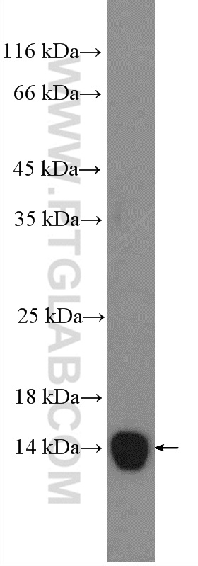 WB analysis of serum from mouse injected with bacteria using 13192-1-AP