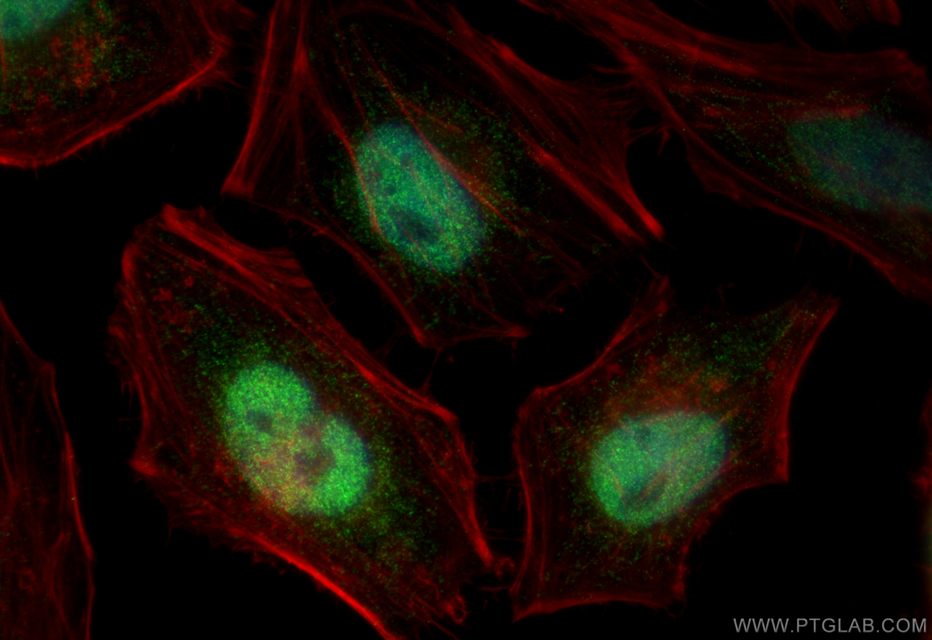 IF Staining of HeLa using 10229-1-AP