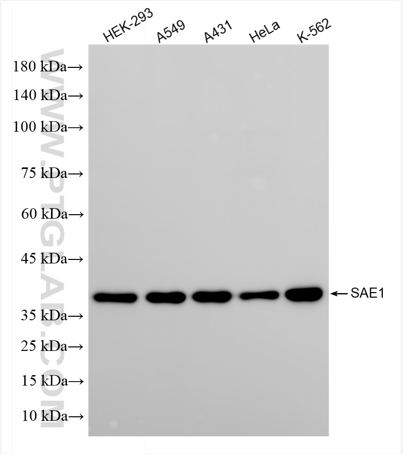 SAE1