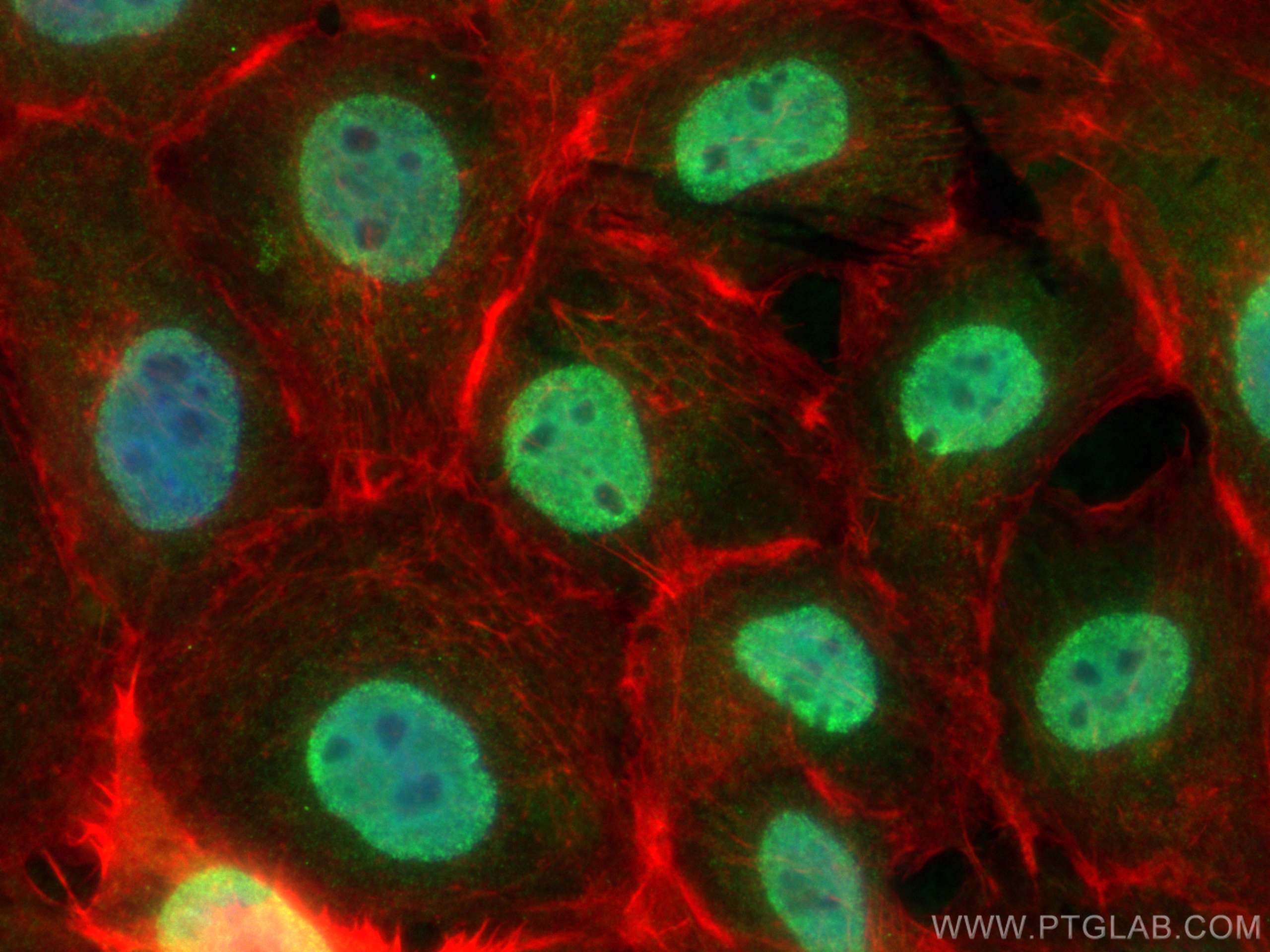 IF Staining of A431 using 21857-1-AP