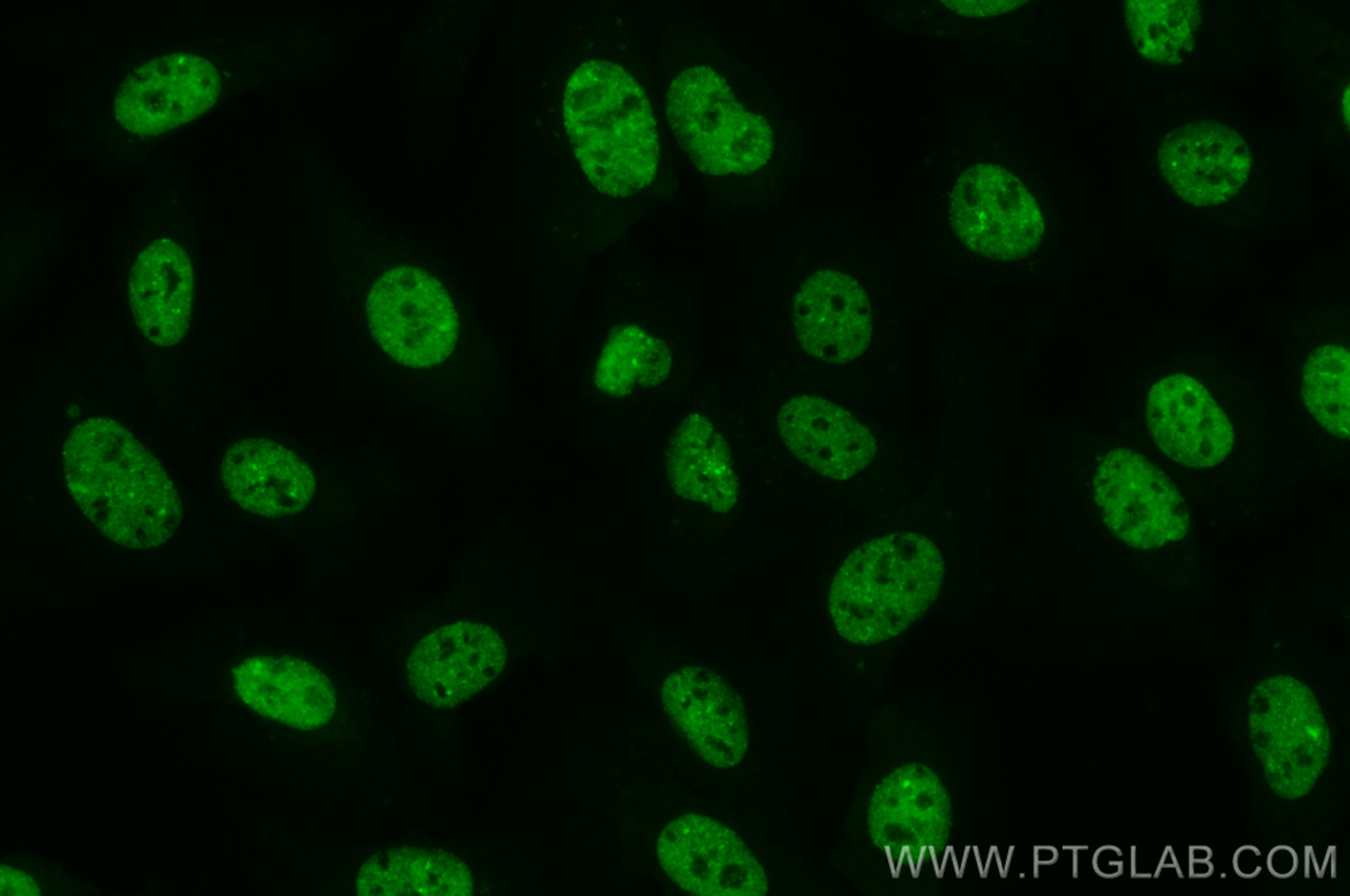 IF Staining of U2OS using CL488-21857