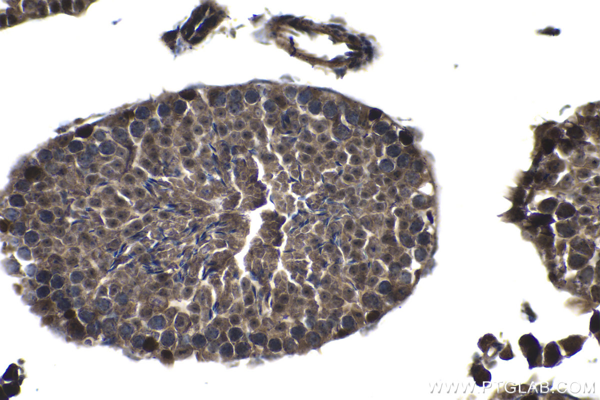 IHC staining of mouse testis using 24500-1-AP