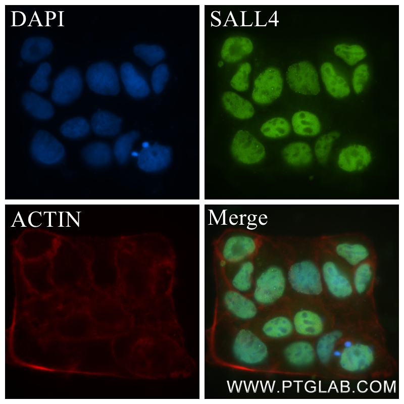 IF Staining of Caco-2 using 83039-4-RR