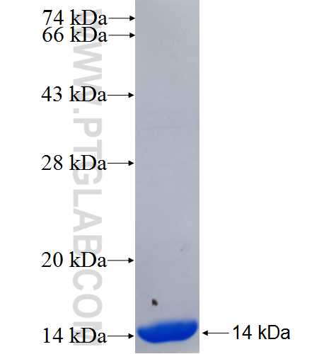 SAMD12 fusion protein Ag25007 SDS-PAGE