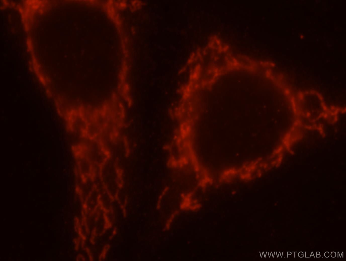 IF Staining of HepG2 using 17723-1-AP