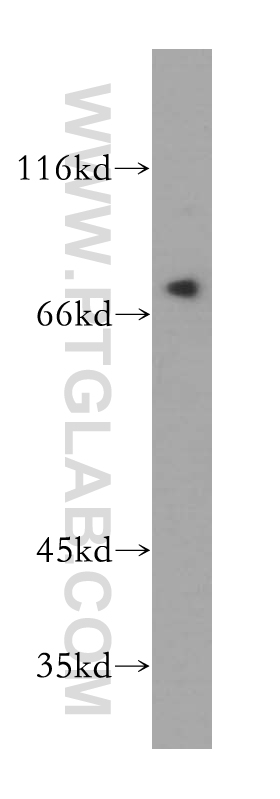 WB analysis of HeLa using 17723-1-AP