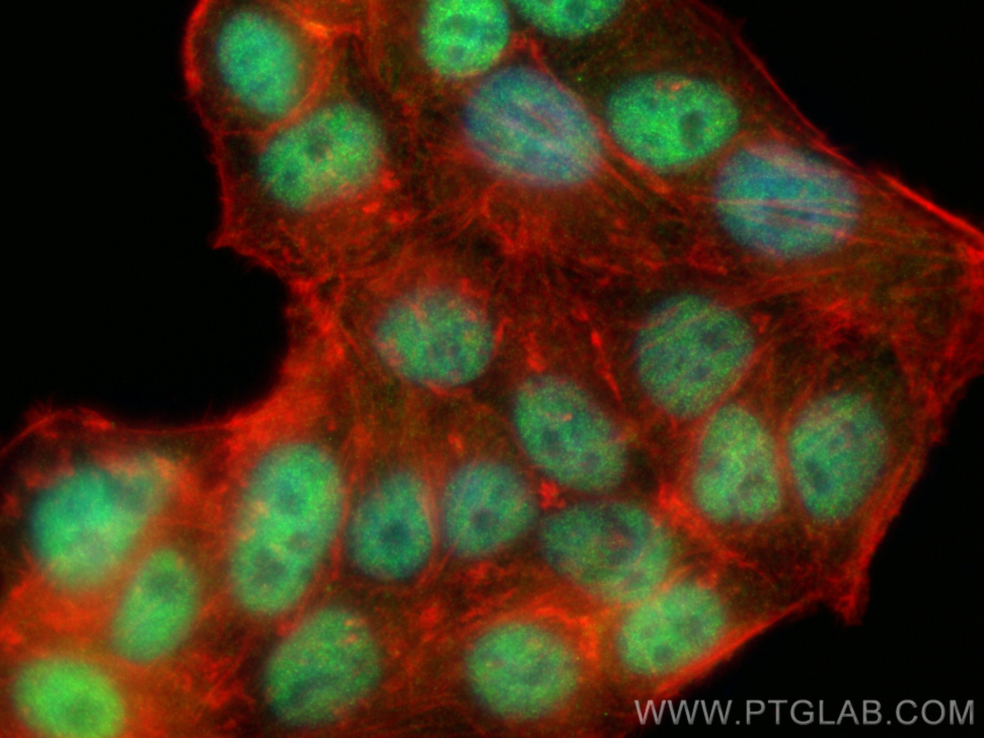 IF Staining of HepG2 using 12586-1-AP