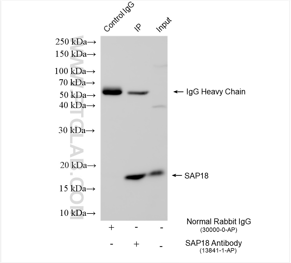 IP experiment of K-562 using 13841-1-AP