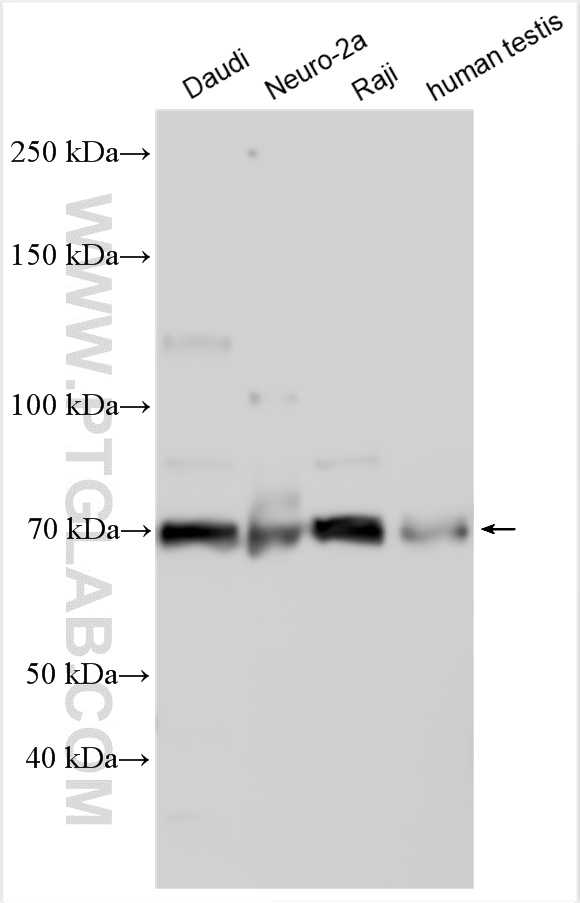 SARM1