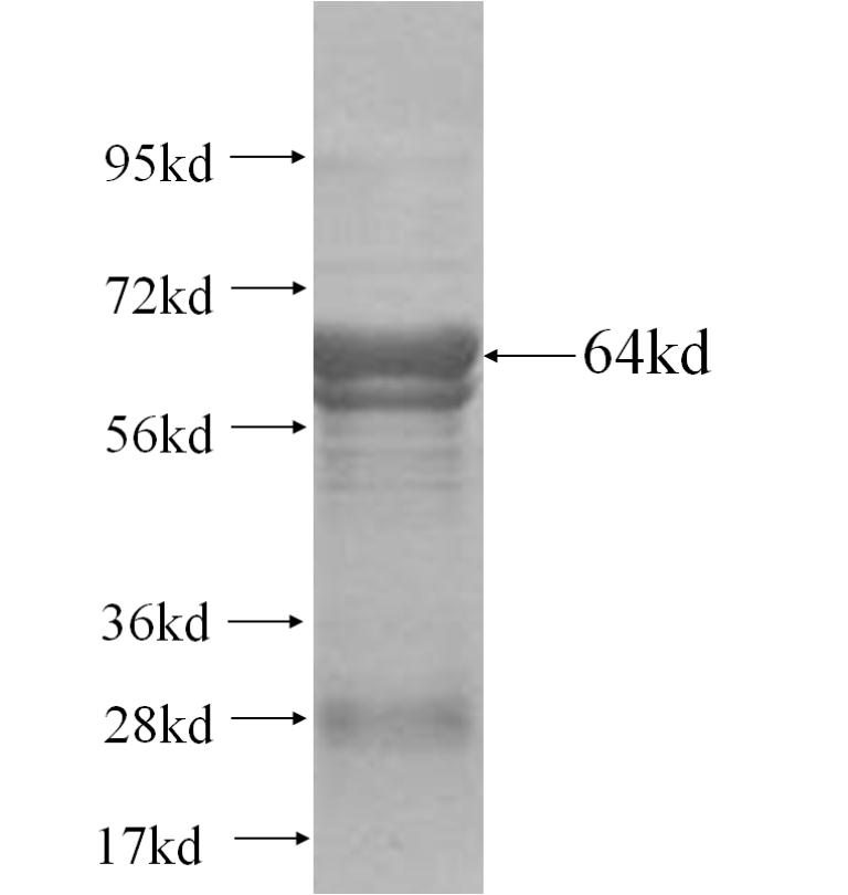 SARS2 fusion protein Ag10913 SDS-PAGE