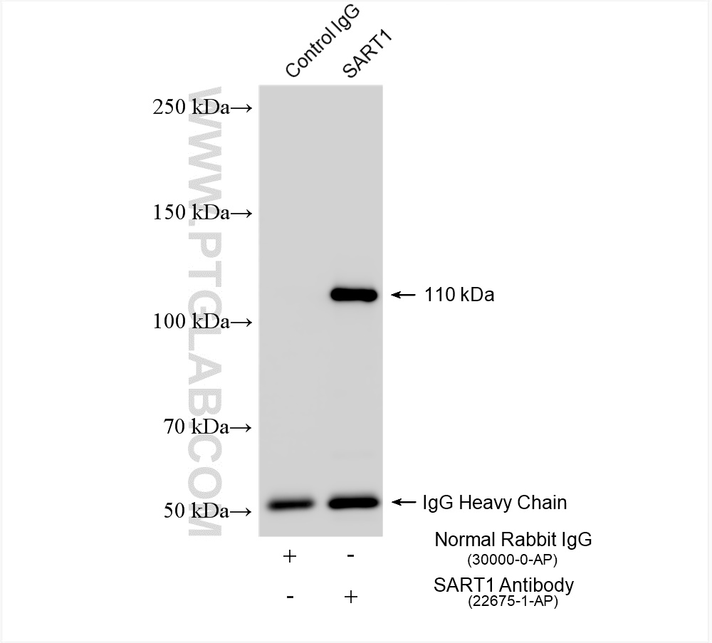 IP experiment of mouse brain using 22675-1-AP