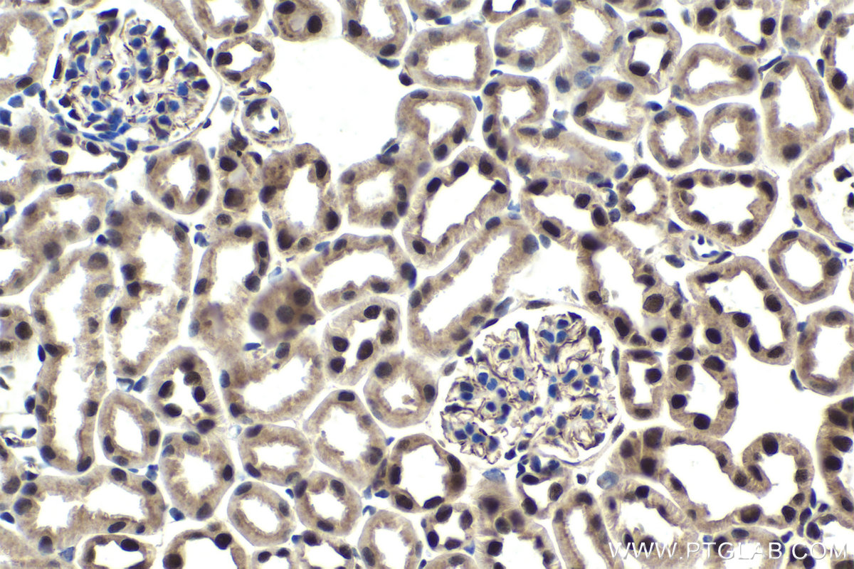 IHC staining of mouse kidney using 18025-1-AP