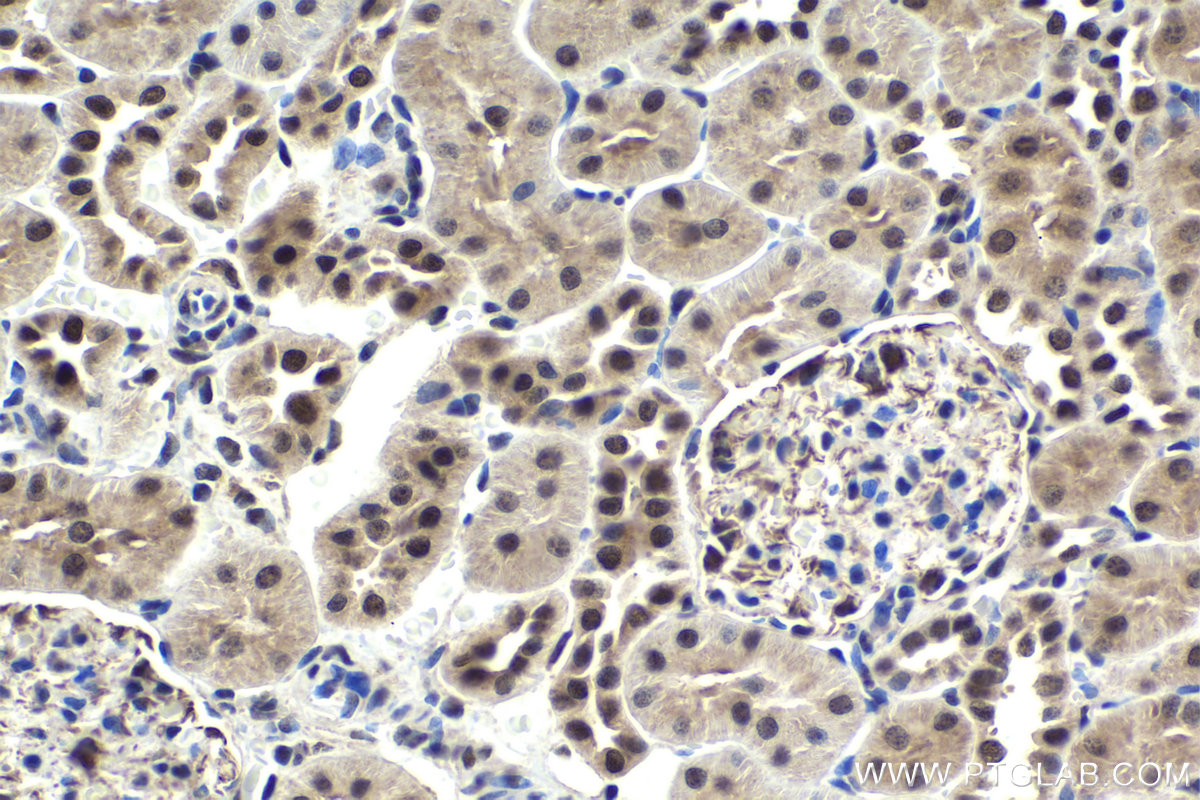 IHC staining of rat kidney using 18025-1-AP