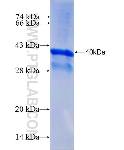 SASH1 fusion protein Ag26771 SDS-PAGE