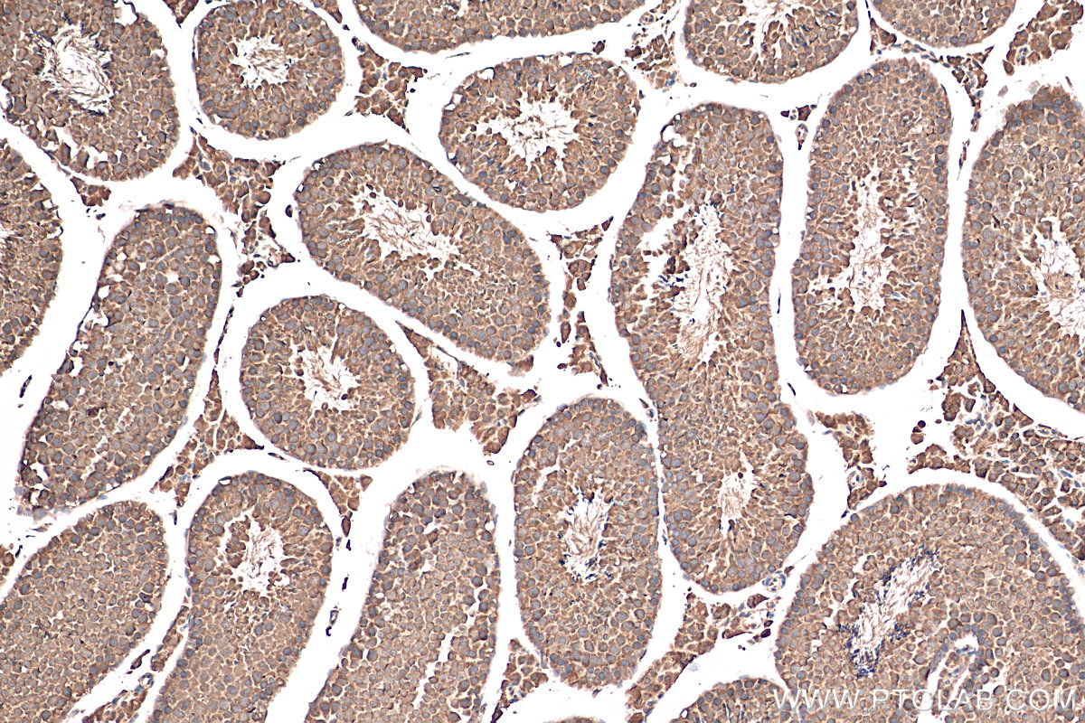 IHC staining of mouse testis using 21377-1-AP