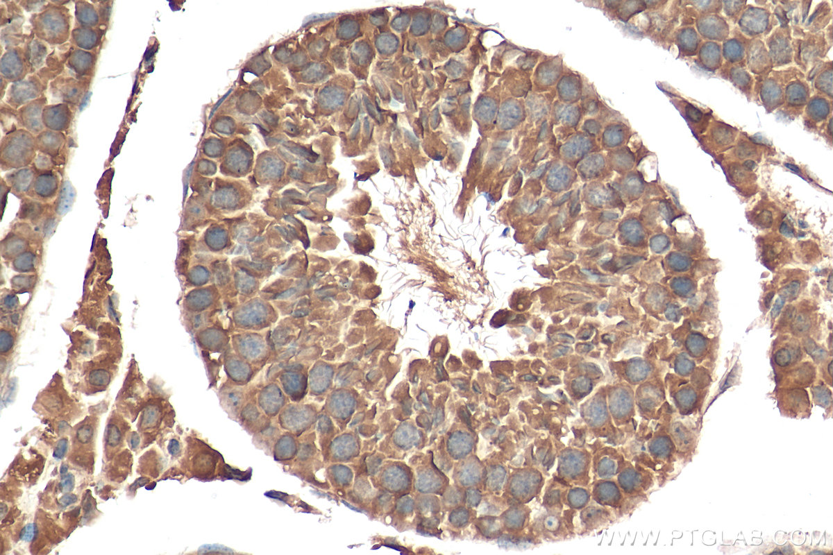 IHC staining of mouse testis using 21377-1-AP