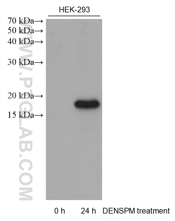 WB analysis using 68928-1-Ig