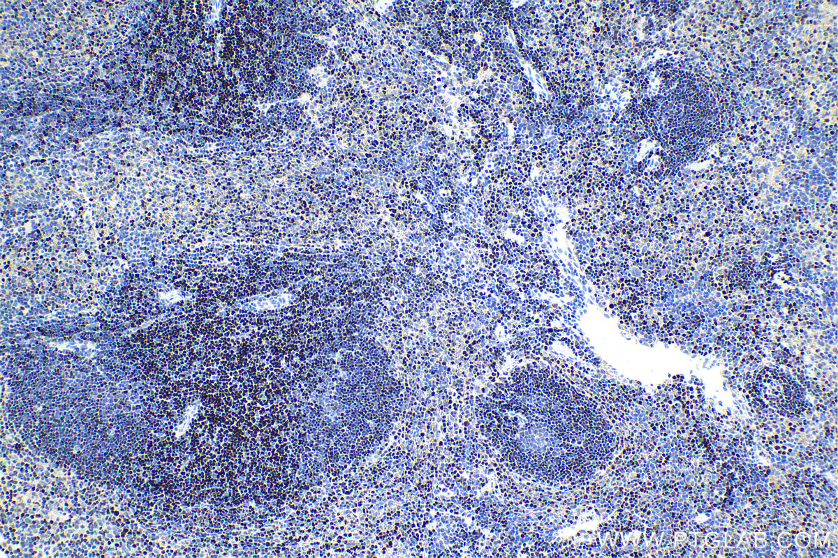 IHC staining of mouse spleen using 15400-1-AP