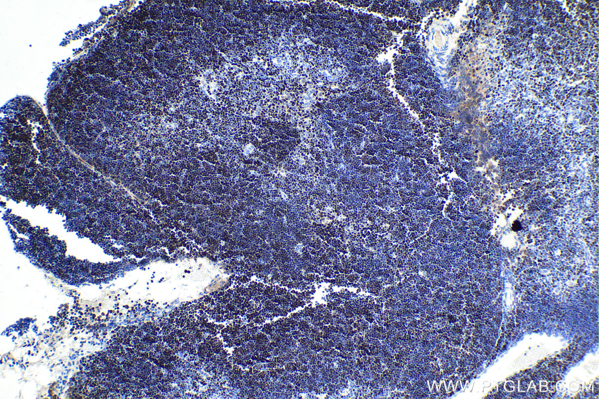 IHC staining of mouse thymus using 15400-1-AP