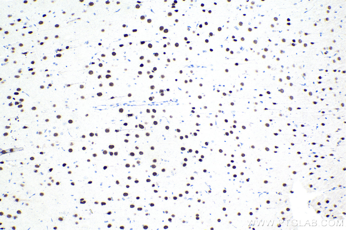 IHC staining of rat brain using 15400-1-AP