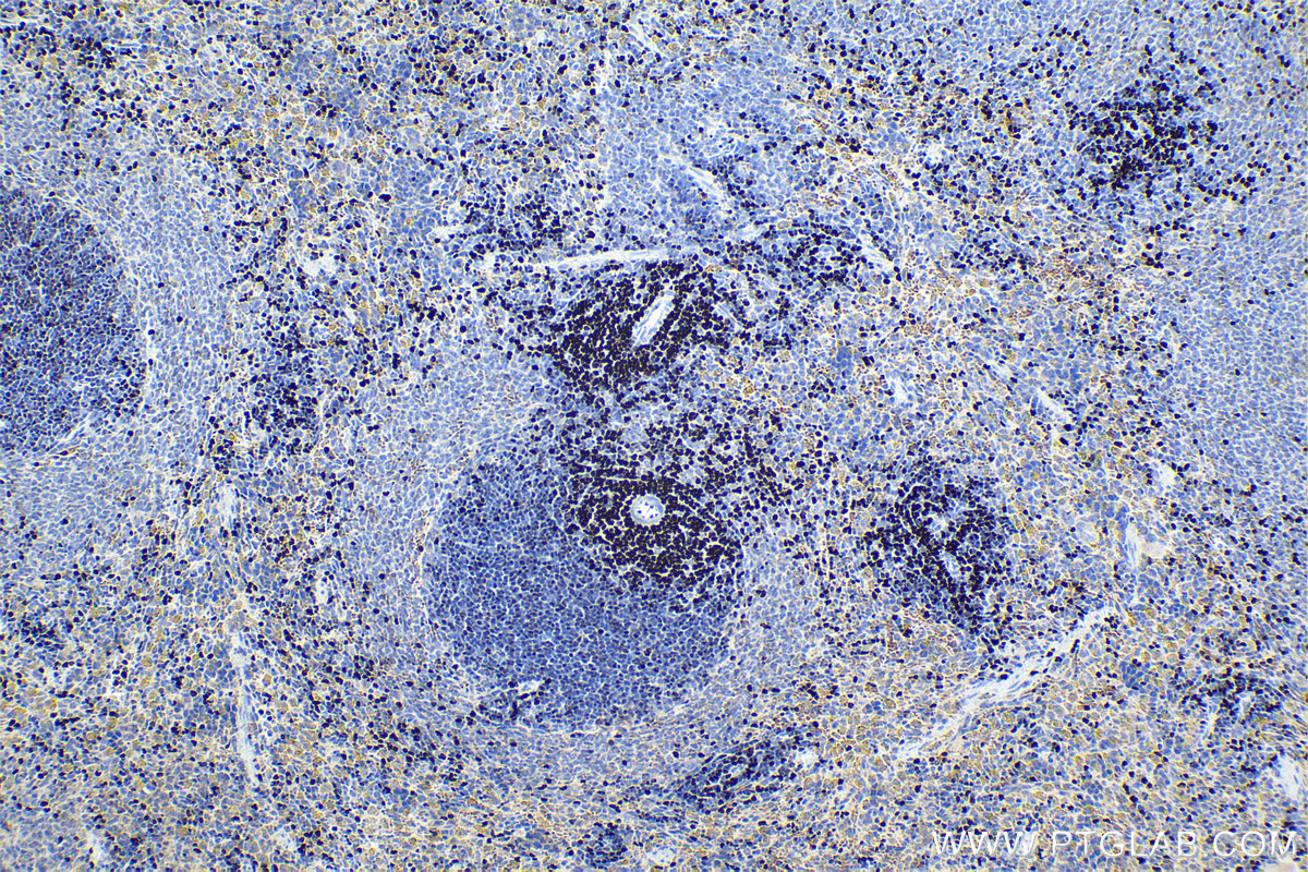 IHC staining of rat spleen using 15400-1-AP