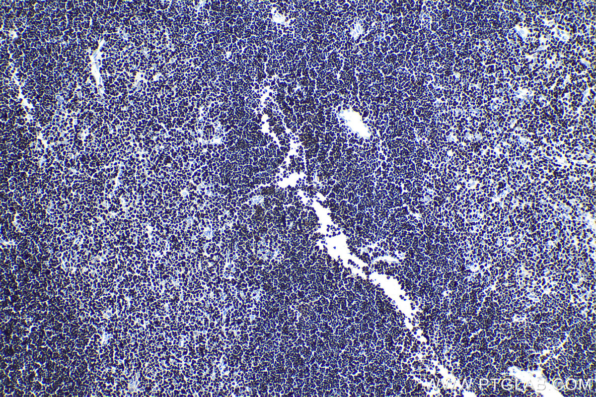 IHC staining of rat thymus using 15400-1-AP