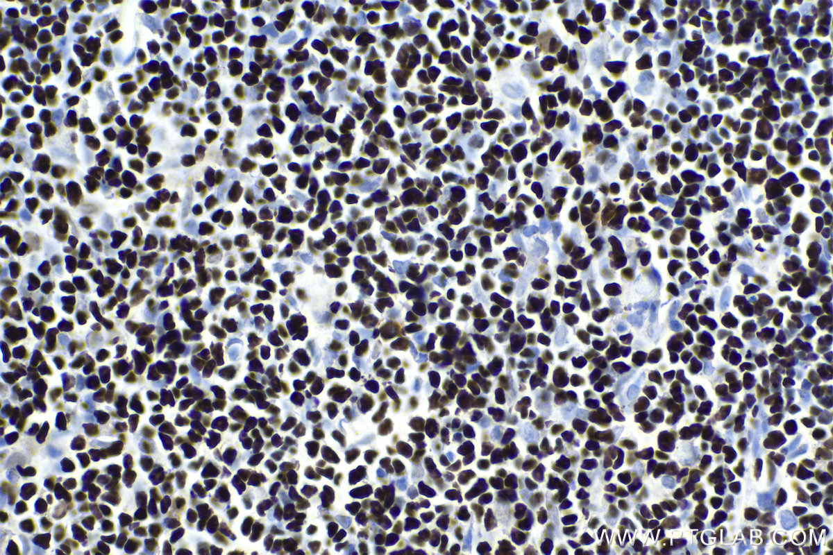 IHC staining of rat thymus using 15400-1-AP